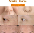 24K Gold Vibrating Beauty Roller